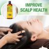 imagePure Cold Pressed Castor Oil  Big 32 fl oz Bottle  Unrefined ampamp Hexane Free  100 Pure Castor Oil for Hair Growth Thicker Eyelashes ampamp Eyebrows Dry Skin Healing Hair Care Joint and Muscle PainRosemary